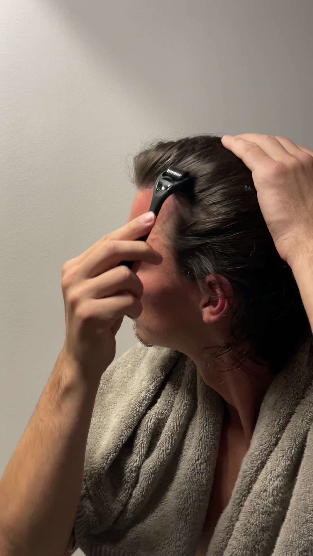 Scalp Activation Derma Roller